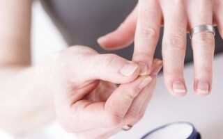 Causes and Treatment of Yellow Nails