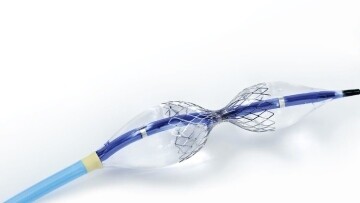 New Procedure for Refractory Angina Introduced in Abu Dhabi