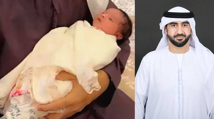 Rare Case in UAE: Newborn Born with a Tooth