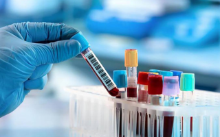 Four Essential Blood Tests After Forty