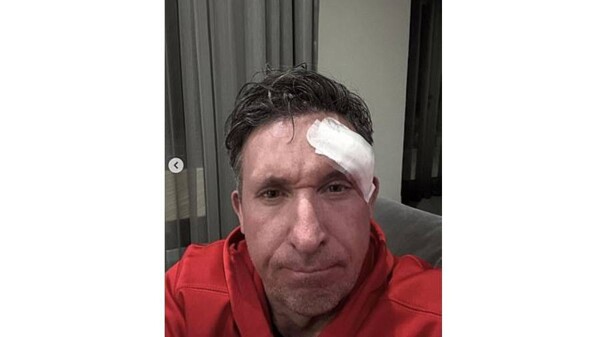 Liverpool legend Robbie Fowler undergoes surgery to remove tumor